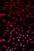 Anti-APEX1 antibody produced in rabbit
