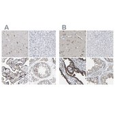 Anti-PCNT antibody produced in rabbit Prestige Antibodies&#174; Powered by Atlas Antibodies, affinity isolated antibody, buffered aqueous glycerol solution, Ab1