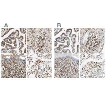 ANTI-SUN1 antibody produced in rabbit Ab2, Prestige Antibodies® Powered by Atlas Antibodies, affinity isolated antibody, buffered aqueous glycerol solution