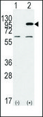 Anti-PYGM (C-term) antibody produced in rabbit Ig fraction of antiserum, buffered aqueous solution