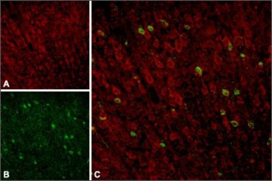 Anti-Sortilin antibody produced in rabbit lyophilized powder, affinity isolated antibody