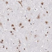 Anti-DDX24 antibody produced in rabbit Prestige Antibodies&#174; Powered by Atlas Antibodies, affinity isolated antibody, buffered aqueous glycerol solution