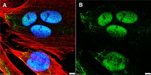 Anti-CDK9 Antibody, clone 1F9 ZooMAb&#174; Rabbit Monoclonal recombinant, expressed in HEK 293 cells