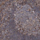 Anti-LRBA antibody produced in rabbit Prestige Antibodies&#174; Powered by Atlas Antibodies, affinity isolated antibody, buffered aqueous glycerol solution, Ab2