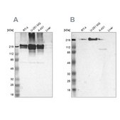 Anti-FLNA antibody produced in rabbit Ab3, Prestige Antibodies&#174; Powered by Atlas Antibodies, affinity isolated antibody, buffered aqueous glycerol solution
