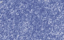 Anti-PD-1 Antibody, clone 1F7 ZooMAb&#174; Rabbit Monoclonal recombinant, expressed in HEK 293 cells
