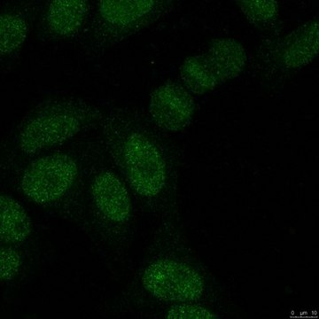 Anti-SUMO-2/3 Antibody, clone 8A2 clone 8A2, from mouse