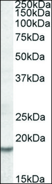 Anti-HMGA2 antibody produced in goat affinity isolated antibody, buffered aqueous solution