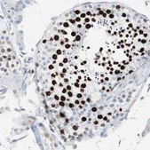 Anti-TOP2A antibody produced in rabbit Prestige Antibodies&#174; Powered by Atlas Antibodies, affinity isolated antibody, buffered aqueous glycerol solution, Ab1