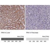 Anti-PAH antibody produced in rabbit Prestige Antibodies&#174; Powered by Atlas Antibodies, affinity isolated antibody, buffered aqueous glycerol solution