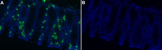 Anti-Eosinophil Peroxidase Antibody, clone AHE-1