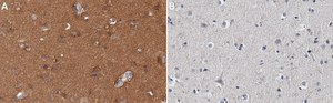 Anti-Tau Antibody, clone Tau 12 ZooMAb&#174; Mouse Monoclonal recombinant, expressed in HEK 293 cells