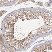 Anti-UPF3B antibody produced in rabbit Ab2, Prestige Antibodies&#174; Powered by Atlas Antibodies, affinity isolated antibody, buffered aqueous glycerol solution