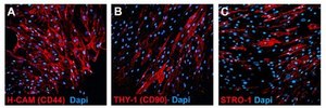 Human Mesenchymal Stem Cells (Bone Marrow) Human mesenchymal stem cells derived from bone marrow that have a capacity for expansion in vitro while maintaining their potential for differentiation to multiple lineages including adipocytes, osteoblasts and chondrocytes.