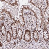 Anti-SNRPC antibody produced in rabbit Prestige Antibodies&#174; Powered by Atlas Antibodies, affinity isolated antibody, buffered aqueous glycerol solution