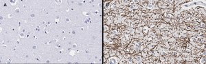 Anti-MBP Antibody, clone 2N6 , ZooMAb&#174; Rabbit Monoclonal recombinant, expressed in HEK 293 cells