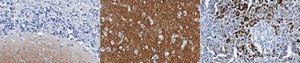 Anti-&#945;-Synuclein Antibody, clone SOY1 clone SOY1, from mouse