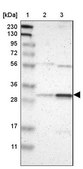 Anti-RAD1 antibody produced in rabbit Prestige Antibodies&#174; Powered by Atlas Antibodies, affinity isolated antibody, buffered aqueous glycerol solution