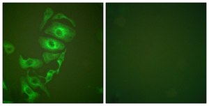 Anti-Keratin 17 antibody produced in rabbit affinity isolated antibody