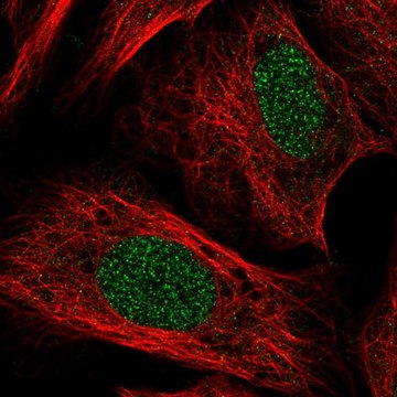 Anti-TOX antibody produced in rabbit Prestige Antibodies&#174; Powered by Atlas Antibodies, affinity isolated antibody