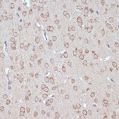 Anti-YAP1 antibody produced in rabbit