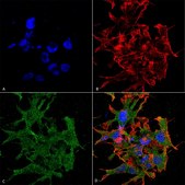 Monoclonal Anti-Cav3.1 - Atto 488 antibody produced in mouse clone S178A-9, purified immunoglobulin