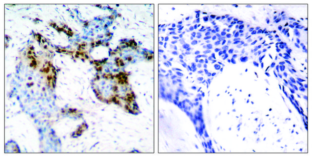 Anti-Estrogen Receptor-&#945; antibody produced in rabbit affinity isolated antibody