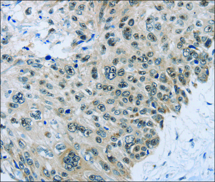 Anti-SLC16A4 antibody produced in rabbit affinity isolated antibody