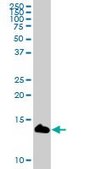 Anti-LY6D antibody produced in mouse purified immunoglobulin, buffered aqueous solution