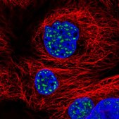 Anti-SON antibody produced in rabbit Prestige Antibodies&#174; Powered by Atlas Antibodies, affinity isolated antibody