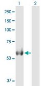 Anti-ALDH4A1 antibody produced in mouse purified immunoglobulin, buffered aqueous solution