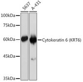 Anti-Cytokeratin 6 (KRT6) Antibody, clone 3F7A1, Rabbit Monoclonal