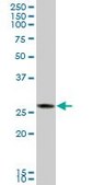 Anti-CTRB1 antibody produced in mouse IgG fraction of antiserum, buffered aqueous solution