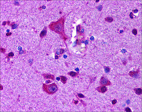 Anti-GSK3B antibody produced in rabbit affinity isolated antibody