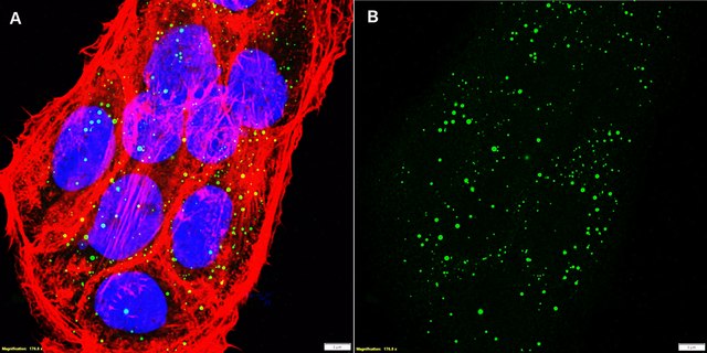 Anti-Filaggrin Antibody, clone AHF3