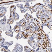 Anti-FABP4 antibody produced in rabbit Prestige Antibodies&#174; Powered by Atlas Antibodies, affinity isolated antibody, buffered aqueous glycerol solution