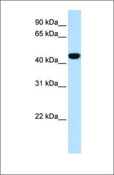 Anti-IDH1 (ab1) antibody produced in rabbit affinity isolated antibody