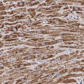 Anti-DECR1 antibody produced in rabbit Prestige Antibodies&#174; Powered by Atlas Antibodies, affinity isolated antibody, buffered aqueous glycerol solution, Ab1