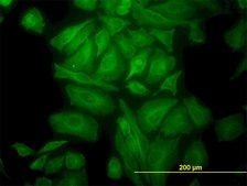 Monoclonal Anti-TUBA1 antibody produced in mouse clone 2E11, purified immunoglobulin, buffered aqueous solution