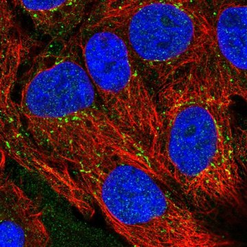 Anti-CXCL16 antibody produced in rabbit Prestige Antibodies&#174; Powered by Atlas Antibodies, affinity isolated antibody