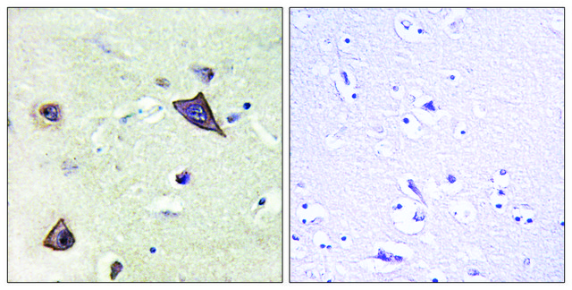 Anti-NMDAR1 antibody produced in rabbit affinity isolated antibody