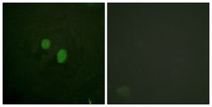 Anti-HMG17 antibody produced in rabbit affinity isolated antibody