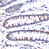 Anti-Aromatase (CYP19A1) Antibody, clone 5C5N7, Rabbit Monoclonal