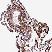 Anti-COL8A1 antibody produced in rabbit Prestige Antibodies&#174; Powered by Atlas Antibodies, affinity isolated antibody, buffered aqueous glycerol solution