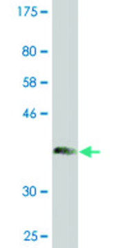 Monoclonal Anti-CHIT1 antibody produced in mouse clone 1D11, purified immunoglobulin, buffered aqueous solution