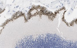 Anti-Bestrophin-1 Antibody, clone E6-6 ZooMAb&#174; Mouse Monoclonal recombinant, expressed in HEK 293 cells
