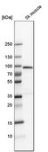 Anti-PFKM antibody produced in rabbit Prestige Antibodies&#174; Powered by Atlas Antibodies, affinity isolated antibody, buffered aqueous glycerol solution