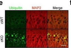 Anti-Microtubule-Associated Protein 2 (MAP2) Antibody Chemicon&#174;, from rabbit