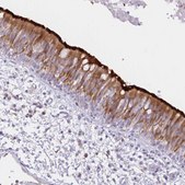 Anti-DNAI2 antibody produced in rabbit Prestige Antibodies&#174; Powered by Atlas Antibodies, affinity isolated antibody, buffered aqueous glycerol solution