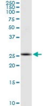 Monoclonal Anti-RNF170 antibody produced in mouse clone 2D6, purified immunoglobulin, buffered aqueous solution